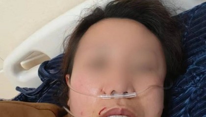 不满孩子被继母要求改口喊“妈妈”，湖南女子称被前夫现任打断5根肋骨？警方刑事立案