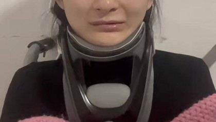 蔡磊回应确诊渐冻症后容貌巨变女生 “无奈她病情迅速进展”